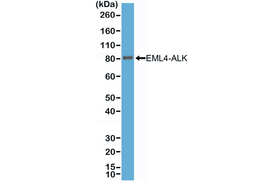 Western Blot - Anti-ALK Antibody [RM361] (A121423) - Antibodies.com