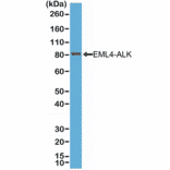 Western Blot - Anti-ALK Antibody [RM361] (A121423) - Antibodies.com