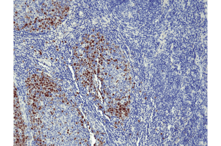 Immunohistochemistry - Anti-Topoisomerase II alpha Antibody [RM394] (A121490) - Antibodies.com