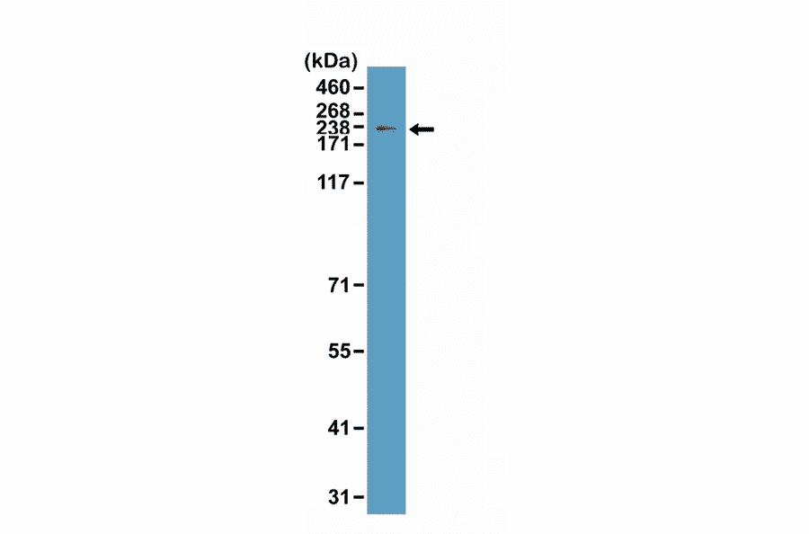 Western Blot - Anti-Topoisomerase II alpha Antibody [RM394] (A121424) - Antibodies.com