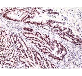 Immunohistochemistry - Anti-MSH3 Antibody [RM405] (A121427) - Antibodies.com