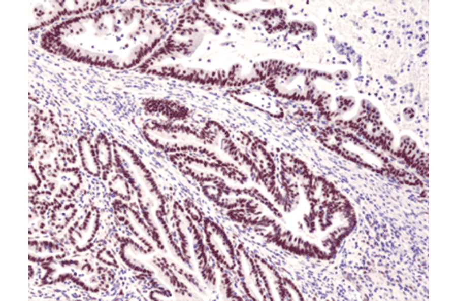 Immunohistochemistry - Anti-MSH3 Antibody [RM405] (A121427) - Antibodies.com