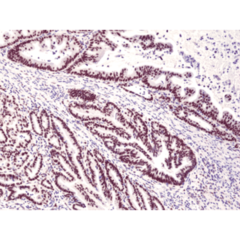 Immunohistochemistry - Anti-MSH3 Antibody [RM405] (A121427) - Antibodies.com