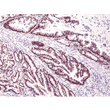 Immunohistochemistry - Anti-MSH3 Antibody [RM405] (A121427) - Antibodies.com