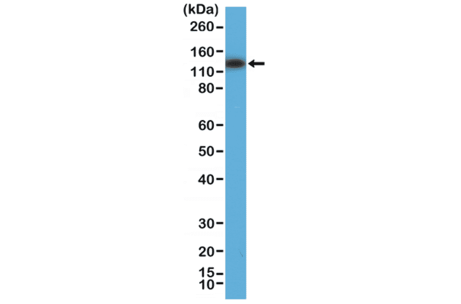 Western Blot - Anti-MSH3 Antibody [RM405] (A121425) - Antibodies.com