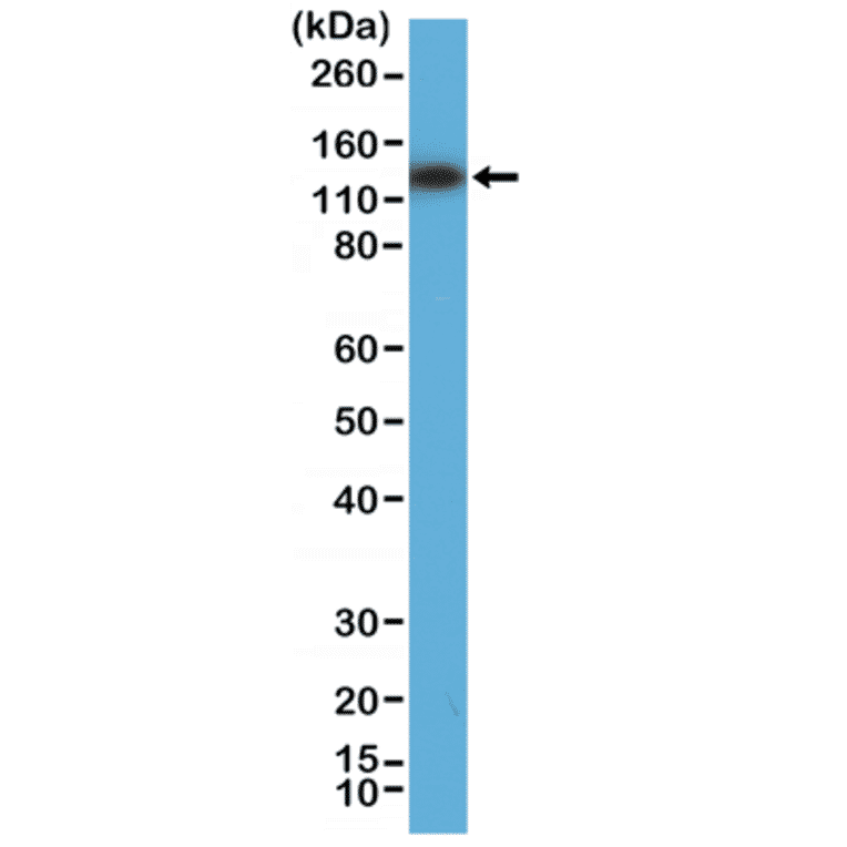 Western Blot - Anti-MSH3 Antibody [RM405] (A121425) - Antibodies.com