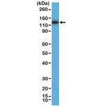 Western Blot - Anti-MSH3 Antibody [RM405] (A121425) - Antibodies.com