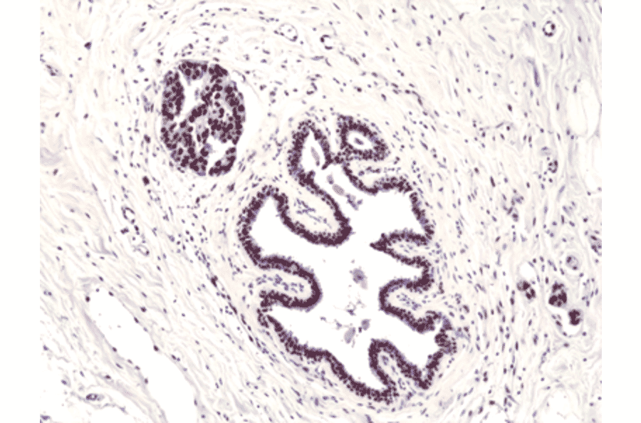 Immunohistochemistry - Anti-FOXP1 Antibody [RM402] (A121228) - Antibodies.com