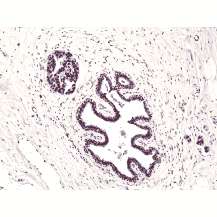 Immunohistochemistry - Anti-FOXP1 Antibody [RM402] (A121228) - Antibodies.com