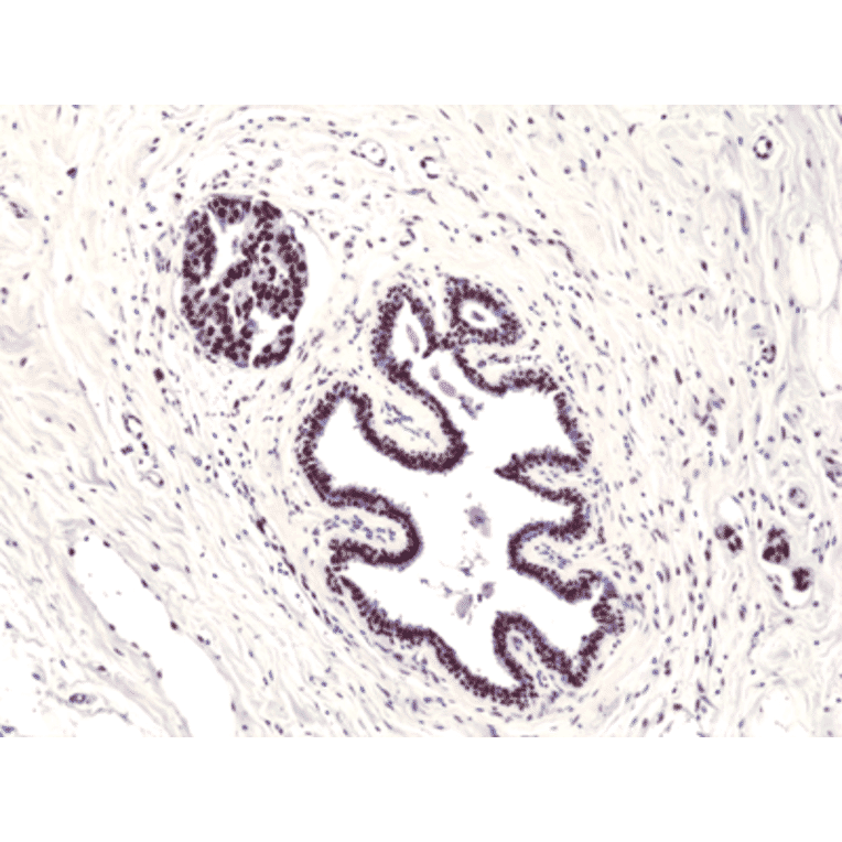 Immunohistochemistry - Anti-FOXP1 Antibody [RM402] (A121228) - Antibodies.com
