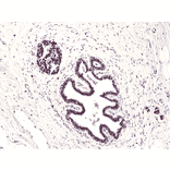 Immunohistochemistry - Anti-FOXP1 Antibody [RM402] (A121228) - Antibodies.com