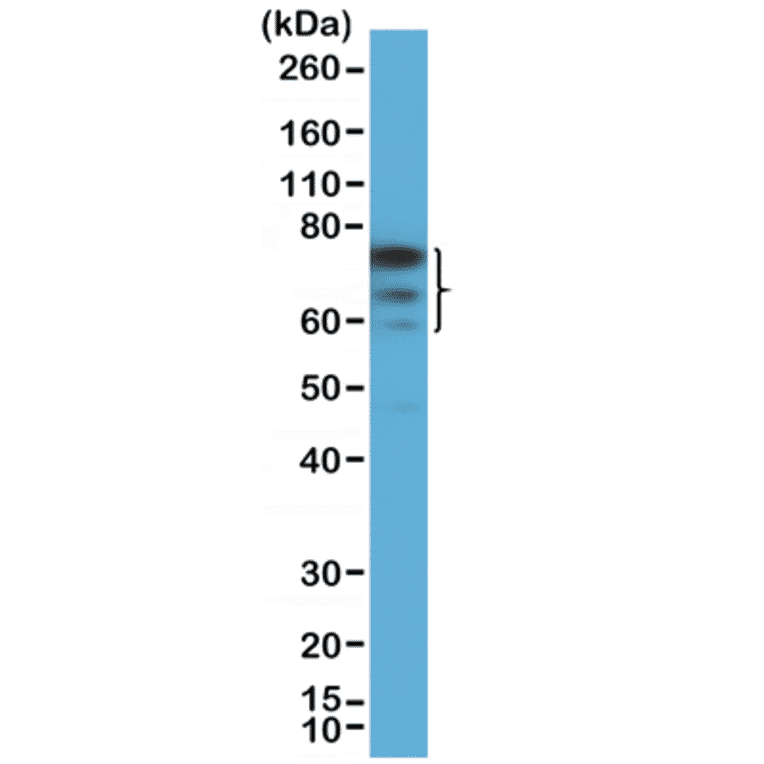 Western Blot - Anti-FOXP1 Antibody [RM402] (A121426) - Antibodies.com
