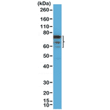 Western Blot - Anti-FOXP1 Antibody [RM402] (A121426) - Antibodies.com