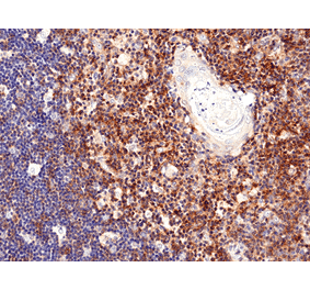 Immunohistochemistry - Anti-CD28 Antibody [RM404] (A121430) - Antibodies.com