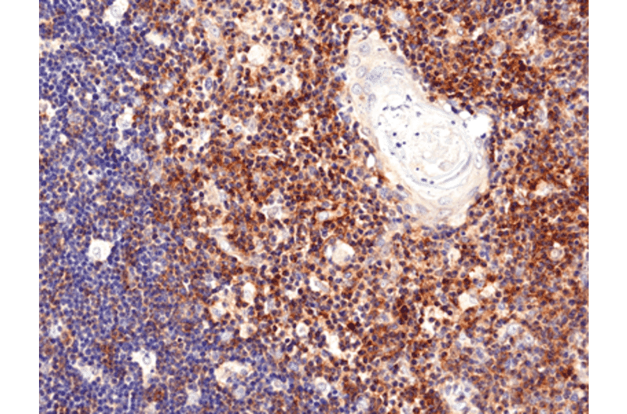 Immunohistochemistry - Anti-CD28 Antibody [RM404] (A121430) - Antibodies.com