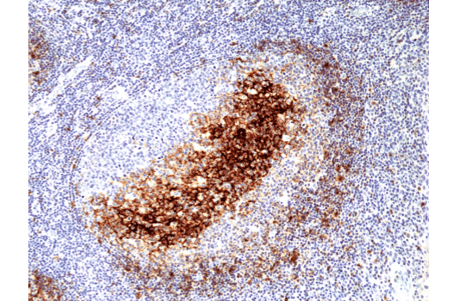 Immunohistochemistry - Anti-CD23 Antibody [RM406] (A121425) - Antibodies.com