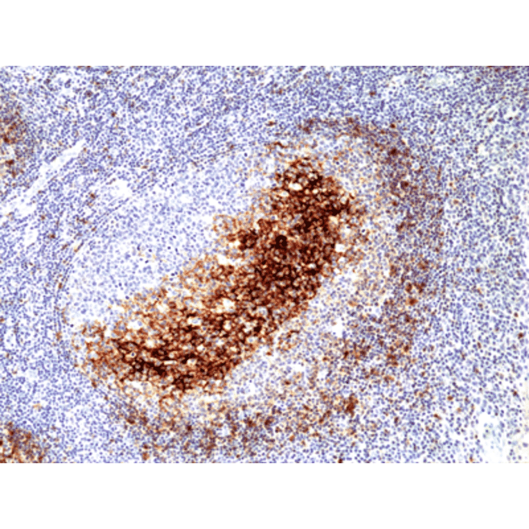 Immunohistochemistry - Anti-CD23 Antibody [RM406] (A121425) - Antibodies.com