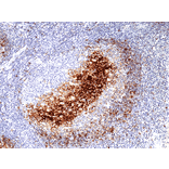 Immunohistochemistry - Anti-CD23 Antibody [RM406] (A121425) - Antibodies.com