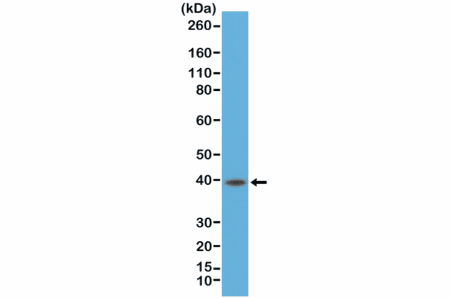 Western Blot - Anti-CD23 Antibody [RM406] (A121428) - Antibodies.com