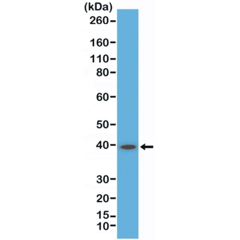 Western Blot - Anti-CD23 Antibody [RM406] (A121428) - Antibodies.com