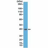 Western Blot - Anti-CD23 Antibody [RM406] (A121428) - Antibodies.com