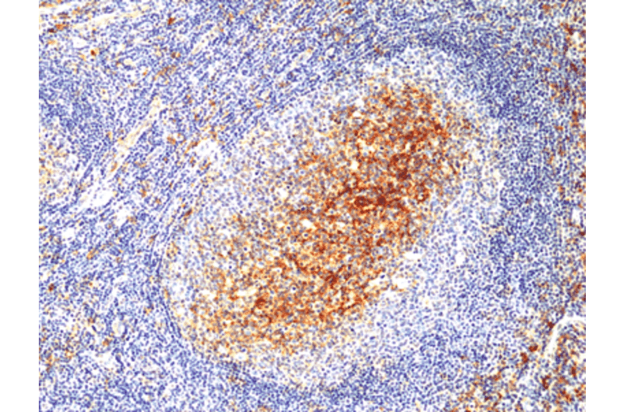 Immunohistochemistry - Anti-CD14 Antibody [RM415] (A121445) - Antibodies.com