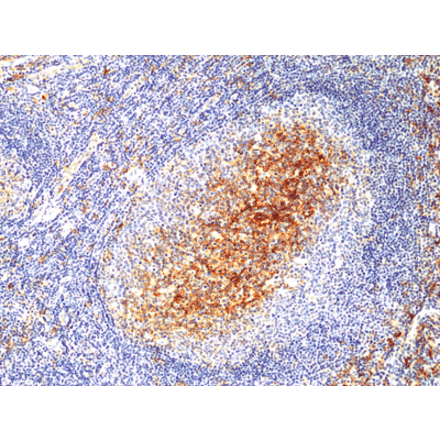 Immunohistochemistry - Anti-CD14 Antibody [RM415] (A121445) - Antibodies.com