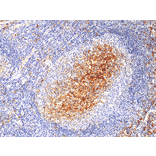 Immunohistochemistry - Anti-CD14 Antibody [RM415] (A121445) - Antibodies.com