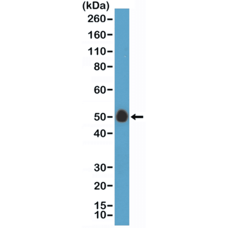 Western Blot - Anti-CD14 Antibody [RM415] (A121429) - Antibodies.com