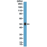 Western Blot - Anti-CD14 Antibody [RM415] (A121429) - Antibodies.com