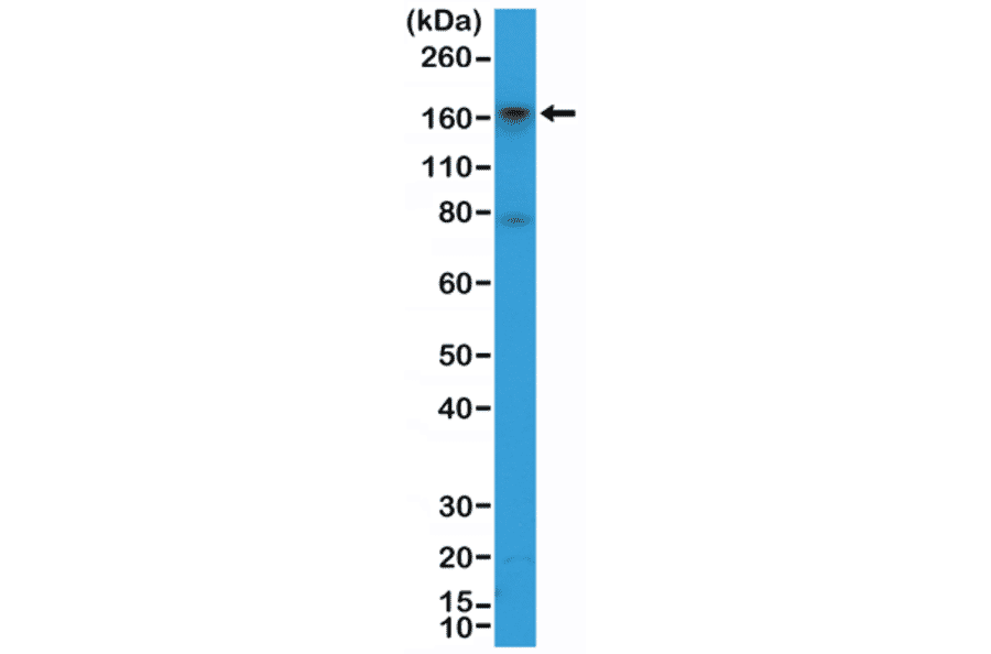 Western Blot - Anti-CD13 Antibody [RM403] (A121430) - Antibodies.com