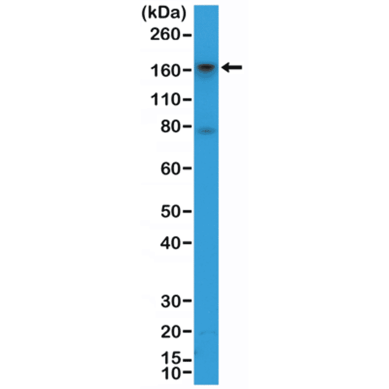 Western Blot - Anti-CD13 Antibody [RM403] (A121430) - Antibodies.com