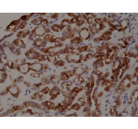 Immunohistochemistry - Anti-Thyroid Peroxidase Antibody [RM368] (A121418) - Antibodies.com