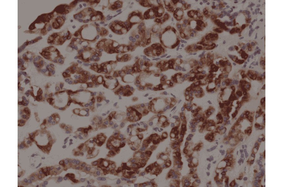 Immunohistochemistry - Anti-Thyroid Peroxidase Antibody [RM368] (A121418) - Antibodies.com