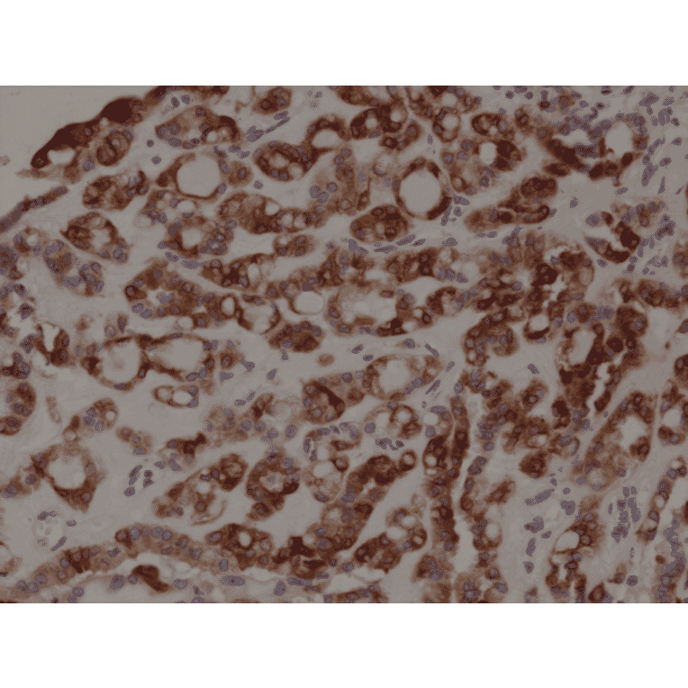Immunohistochemistry - Anti-Thyroid Peroxidase Antibody [RM368] (A121418) - Antibodies.com