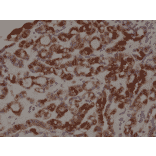 Immunohistochemistry - Anti-Thyroid Peroxidase Antibody [RM368] (A121418) - Antibodies.com