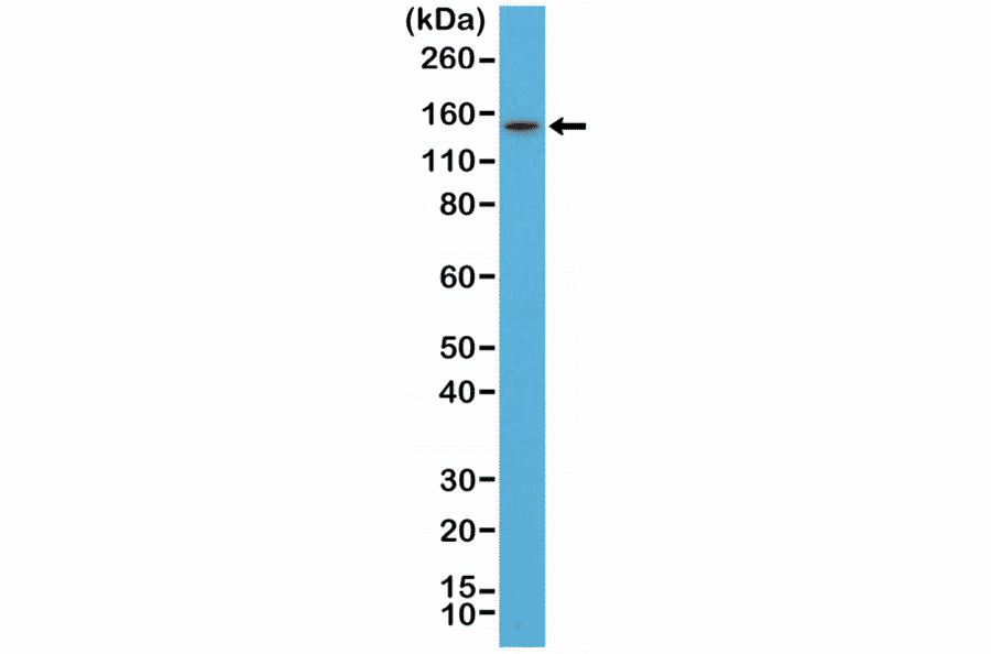 Western Blot - Anti-Thyroid Peroxidase Antibody [RM368] (A121431) - Antibodies.com
