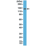 Western Blot - Anti-Thyroid Peroxidase Antibody [RM368] (A121431) - Antibodies.com