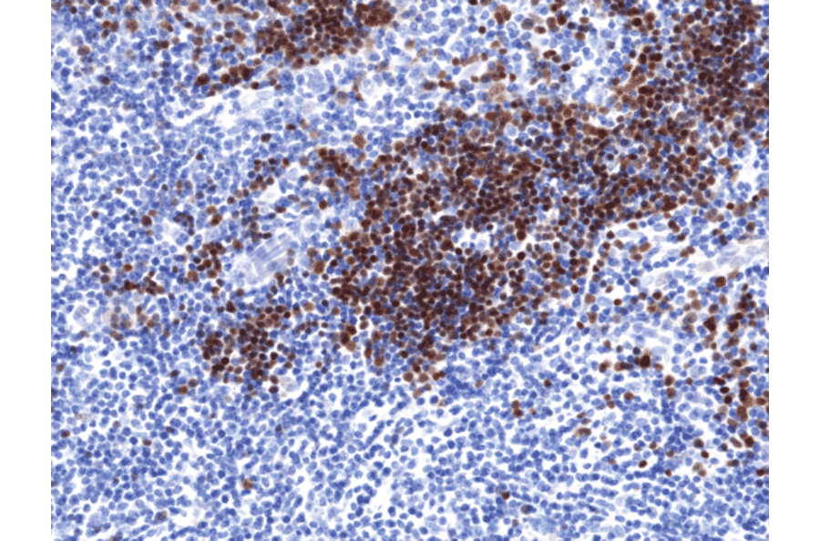 Immunohistochemistry - Anti-TdT Antibody [RM379] (A121497) - Antibodies.com