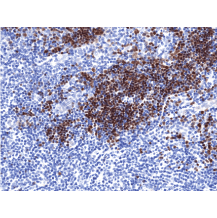 Immunohistochemistry - Anti-TdT Antibody [RM379] (A121497) - Antibodies.com