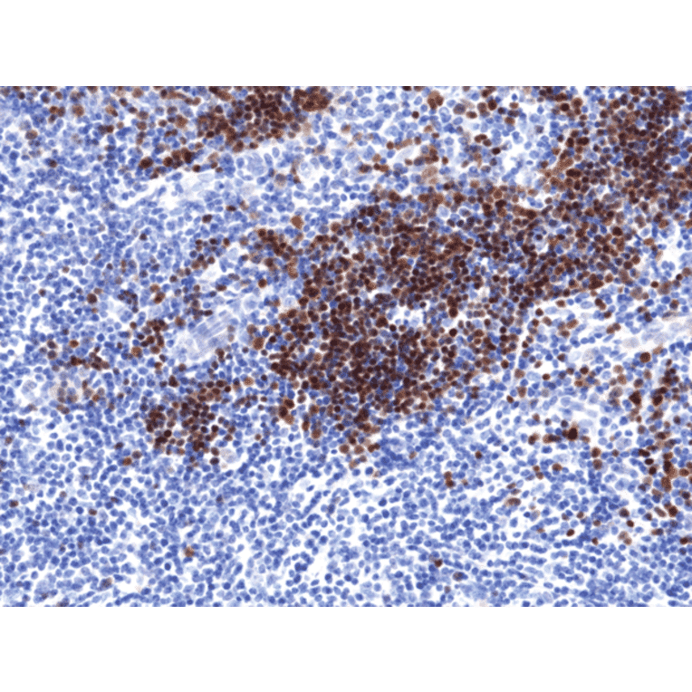 Immunohistochemistry - Anti-TdT Antibody [RM379] (A121497) - Antibodies.com
