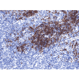 Immunohistochemistry - Anti-TdT Antibody [RM379] (A121497) - Antibodies.com