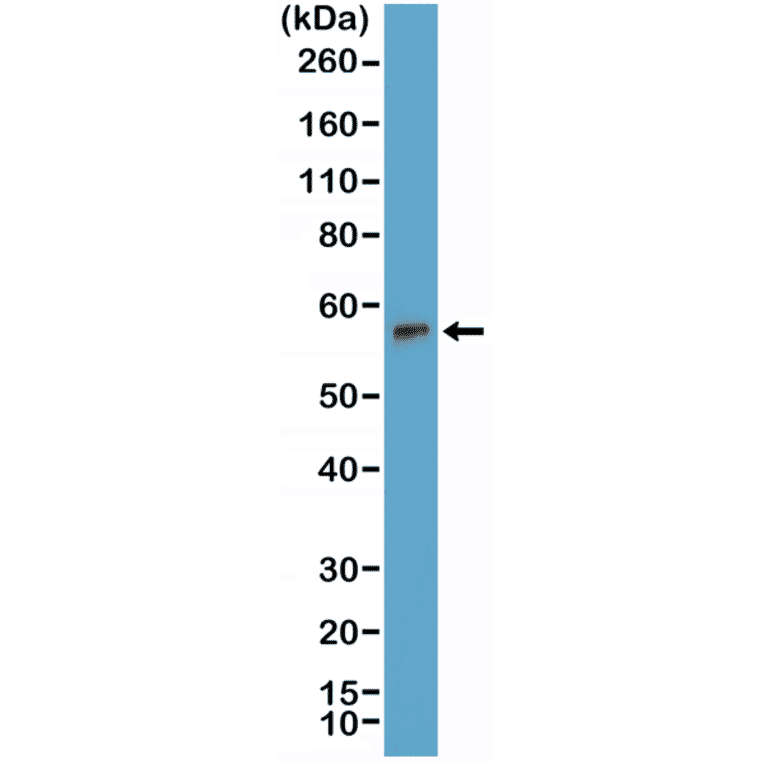 Western Blot - Anti-TdT Antibody [RM379] (A121432) - Antibodies.com