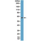 Western Blot - Anti-TdT Antibody [RM379] (A121432) - Antibodies.com