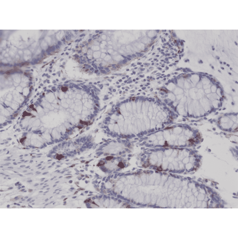 Immunohistochemistry - Anti-Synaptophysin Antibody [RM258] (A121401) - Antibodies.com