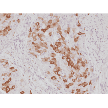 Immunohistochemistry - Anti-Surfactant protein A Antibody [RM334] (A121454) - Antibodies.com