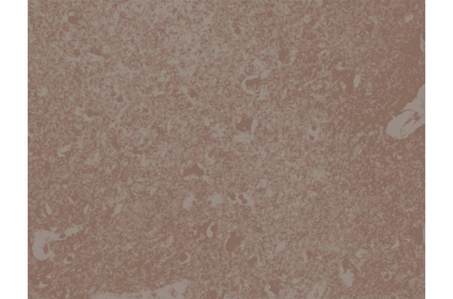 Immunohistochemistry - Anti-Spastin Antibody [RM346] (A121409) - Antibodies.com