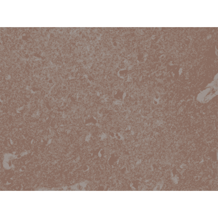 Immunohistochemistry - Anti-Spastin Antibody [RM346] (A121409) - Antibodies.com