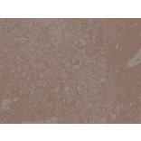 Immunohistochemistry - Anti-Spastin Antibody [RM346] (A121409) - Antibodies.com