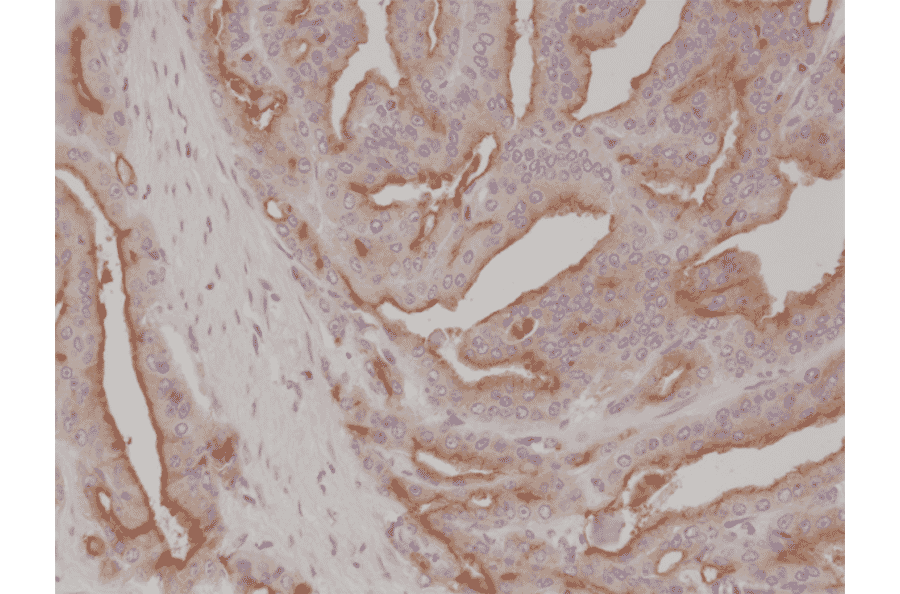 Immunohistochemistry - Anti-PSMA Antibody [RM327] (A121495) - Antibodies.com